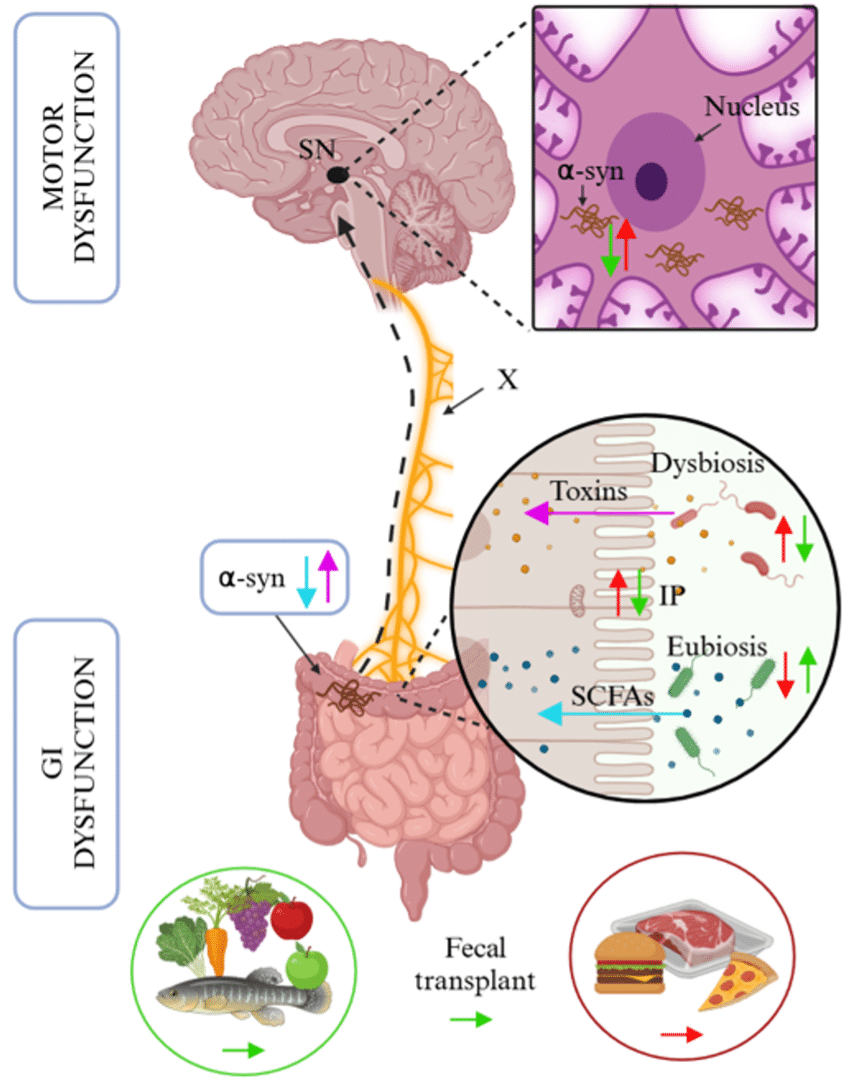 Per què cada vegada hi ha més problemes digestius?